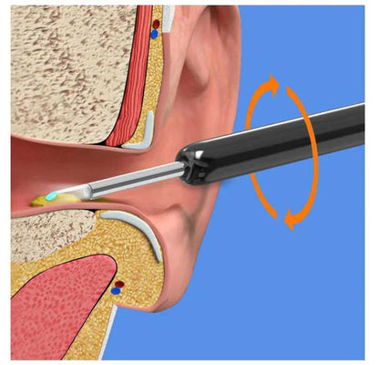 Earwax Removal Kit | مجموعة إزالة شمع الأذن